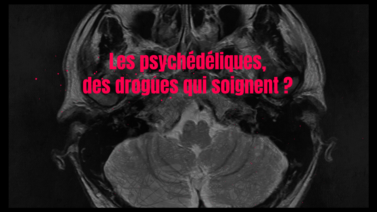 Heilende Drogen / Les psychédéliques, des drogues qui soignent ? ARTE TV Haupttitel, Bauchbinden, Erklärgrafiken – example image of the animation | MARIA LISSEL Animation + Motion Design | maria-lissel.de